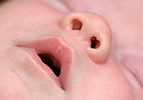 宝宝鼻塞怎么办 出现这些问题应及时就医