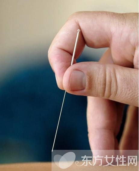 针灸减肥误区须知 针灸减肥的副作用有哪些