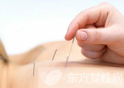 针灸减肥误区须知 针灸减肥的副作用有哪些