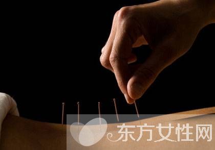 针灸减肥误区须知 针灸减肥的副作用有哪些