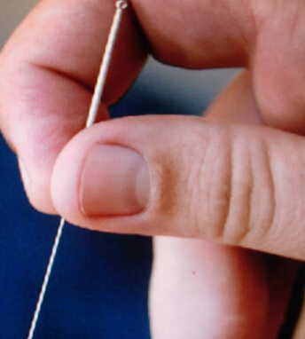 针灸减肥 针灸减肥十大常见问题