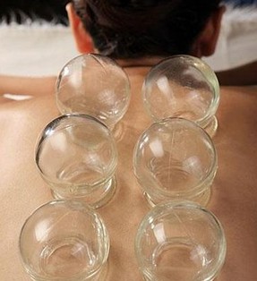 拔罐减肥原理 中医拔罐减肥效果及适用人群