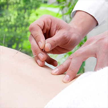 如何减肥 隐形针灸减肥三大减肥作用