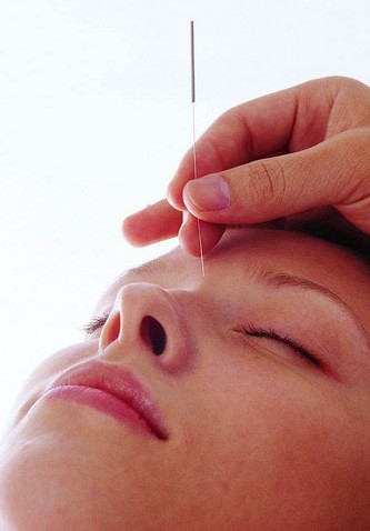 针灸减肥副作用 针灸减肥治内分泌失调