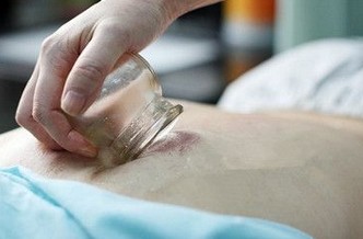 拔火罐后注意事项 拔罐减肥的副作用与危害