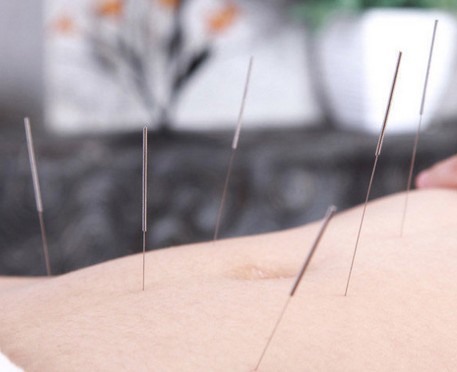 健康减肥 哪些体质用针灸减肥肯定能瘦