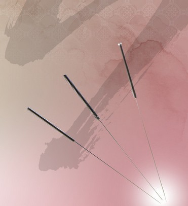 中医健康减肥 常用5种的针灸减肥方法