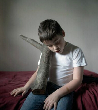 自闭症的表现 患上自闭症的原因有哪些