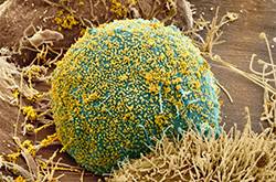 轮状病毒疫苗什么时候接种 轮状病毒疫苗的接种注意事项