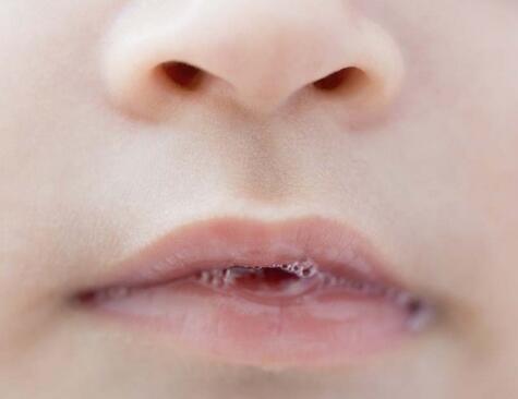 宝宝肺炎早期症状有哪些 宝宝咳嗽需当心