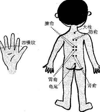 小儿腹泻、厌食该怎么办 选择小儿推拿穴位养生