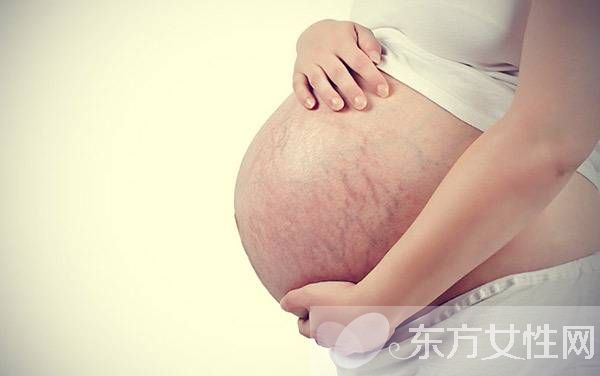 产后如何去掉妊娠纹 这些错误方法赶紧改过来