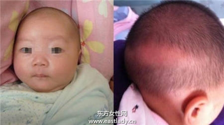 误区 给宝宝剃胎毛头发会会长得浓密