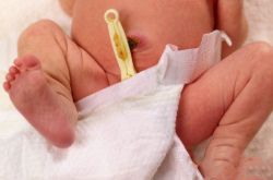初生婴儿脐带护理方法 出现这些情况应及时就医