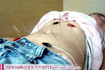 针灸治疗中应注意的问题