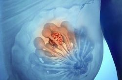 小叶增生症状是怎么样的 引起小叶增生的原因有哪些