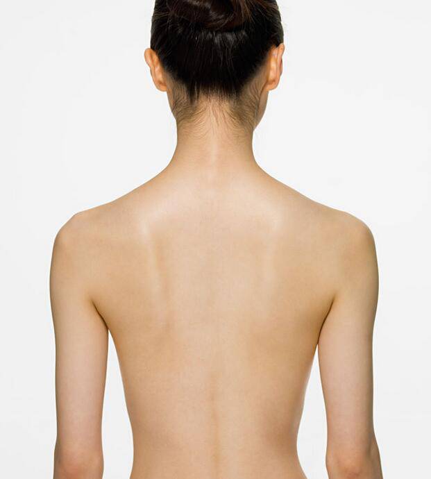 女性雌激素分泌过高 当心子宫肌瘤找上门