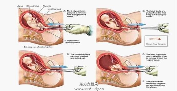 流产后吃什么好 这些流产后调养千万别忽略