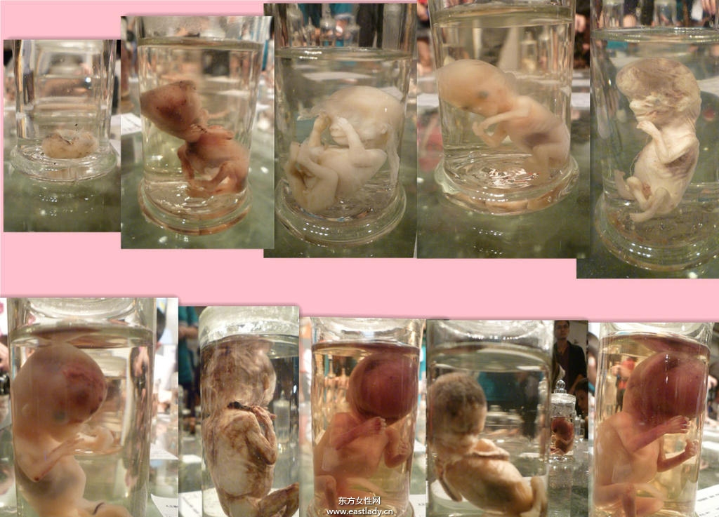 流产后吃什么好 这些流产后调养千万别忽略