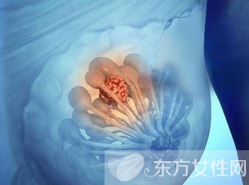 小叶增生症状是怎么样的 引起小叶增生的原因有哪些