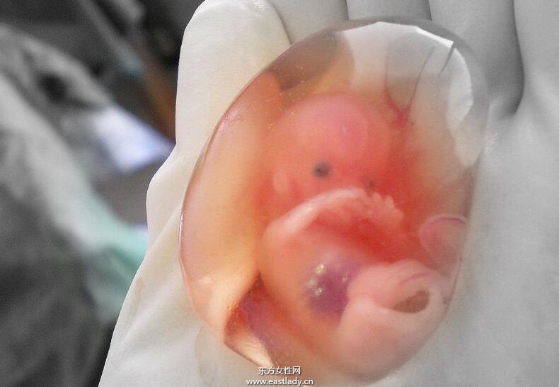 流产后吃什么好 这些流产后调养千万别忽略