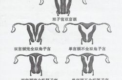 子宫发育不良的症状表现 子宫异常的危害居然这么大