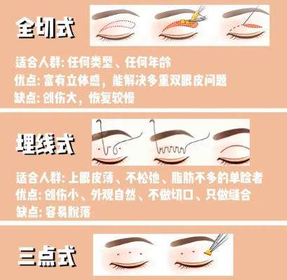 双眼皮