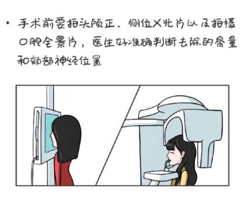 颌面整形