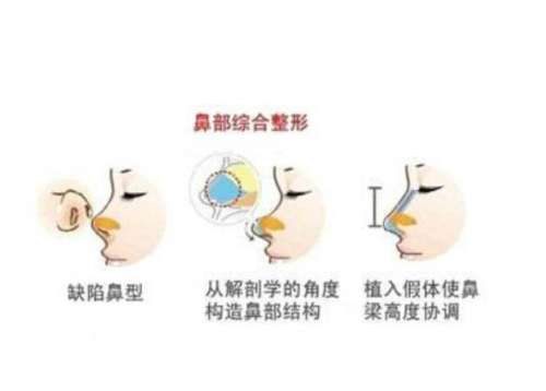 鼻综合2.jpg