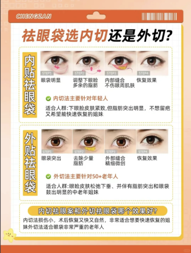 截屏2026-01-04 17.35.55.png