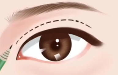 QQ截图20260308164344.png