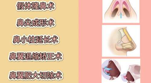 鼻综合 鼻综合