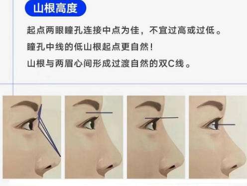 隆鼻13.jpg 隆鼻13.jpg