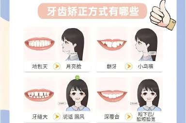 牙齿矫正