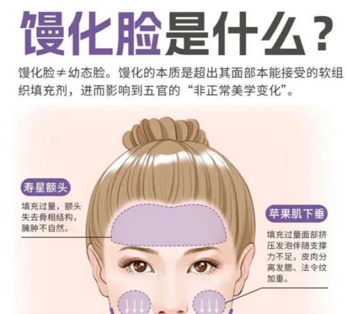 面部注射物