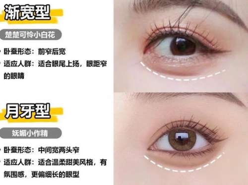 真皮卧蚕再造dm 真皮卧蚕再造dm