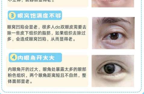 眼整形.jpg 眼整形.jpg