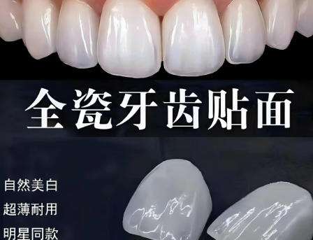 贴面
