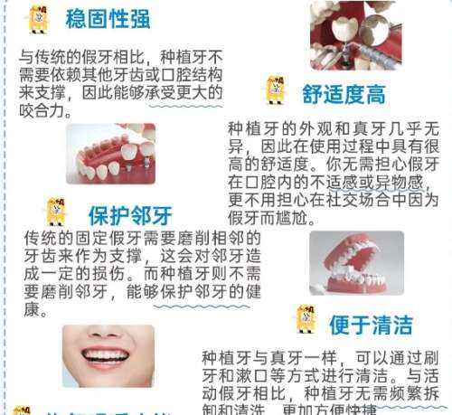 牙齿种植 牙齿种植