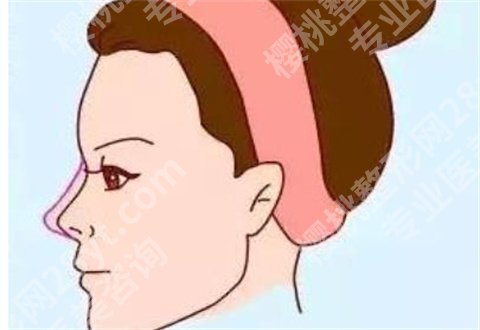上海艺星医疗美容医院隆鼻时有监控吗?一键戳进查看,附价格表