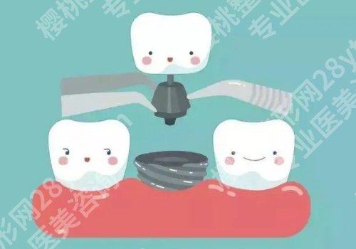 南通种牙哪个医院好?南大附院、第一人民医院等口碑高!