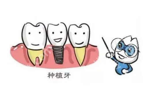 南通种牙哪个医院好?南大附院、第一人民医院等口碑高!