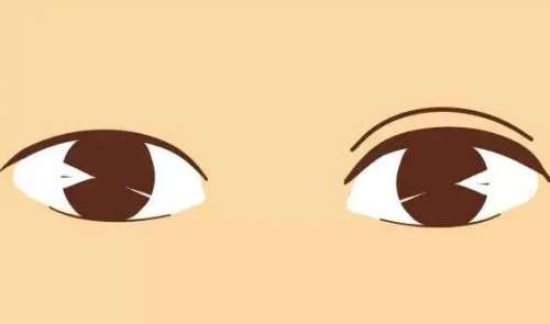 单眼皮 单眼皮