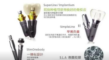 上海科瓦口腔种植牙多少钱？价格表23年_近期案例反馈图