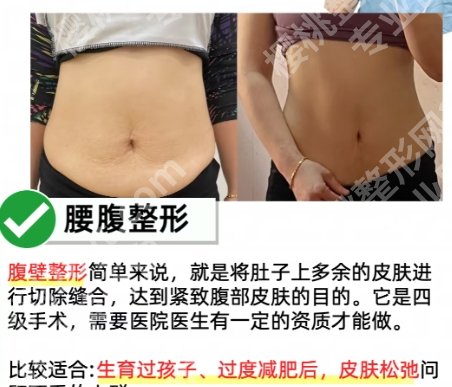 北京孙泽芳怎么咨询?医生简介|真人面诊过程附上!