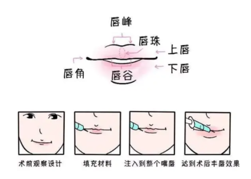 M唇1.png