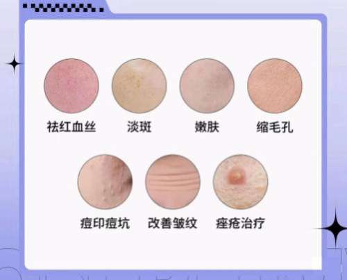 光子嫩肤 光子嫩肤