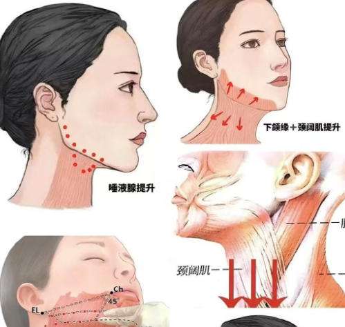 玻尿酸