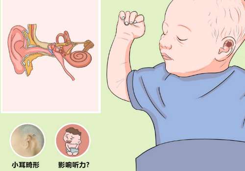 耳部畸形.jpg