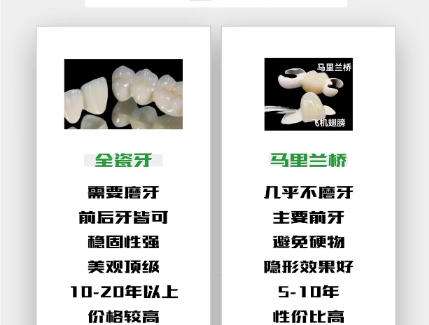 全瓷